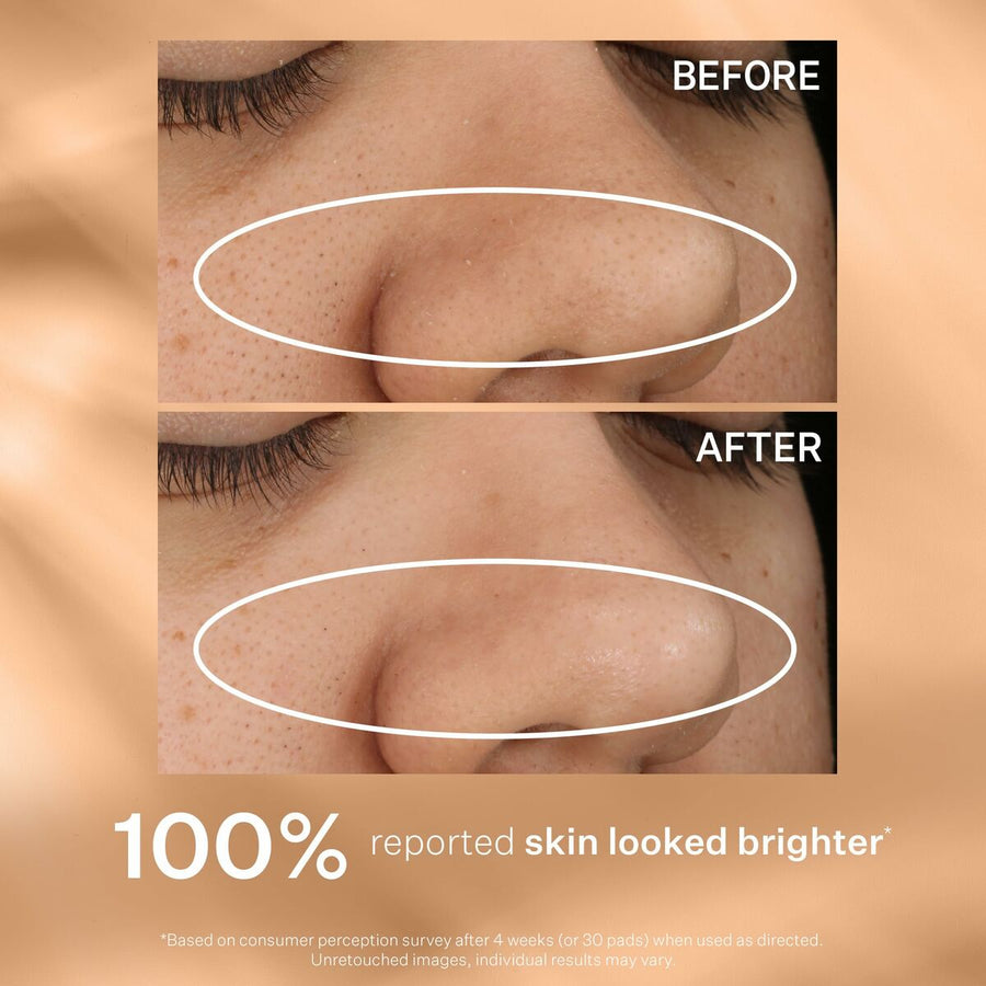 V2H72432FC4EC50195EE2436F7FD6A0062ER7352206P6